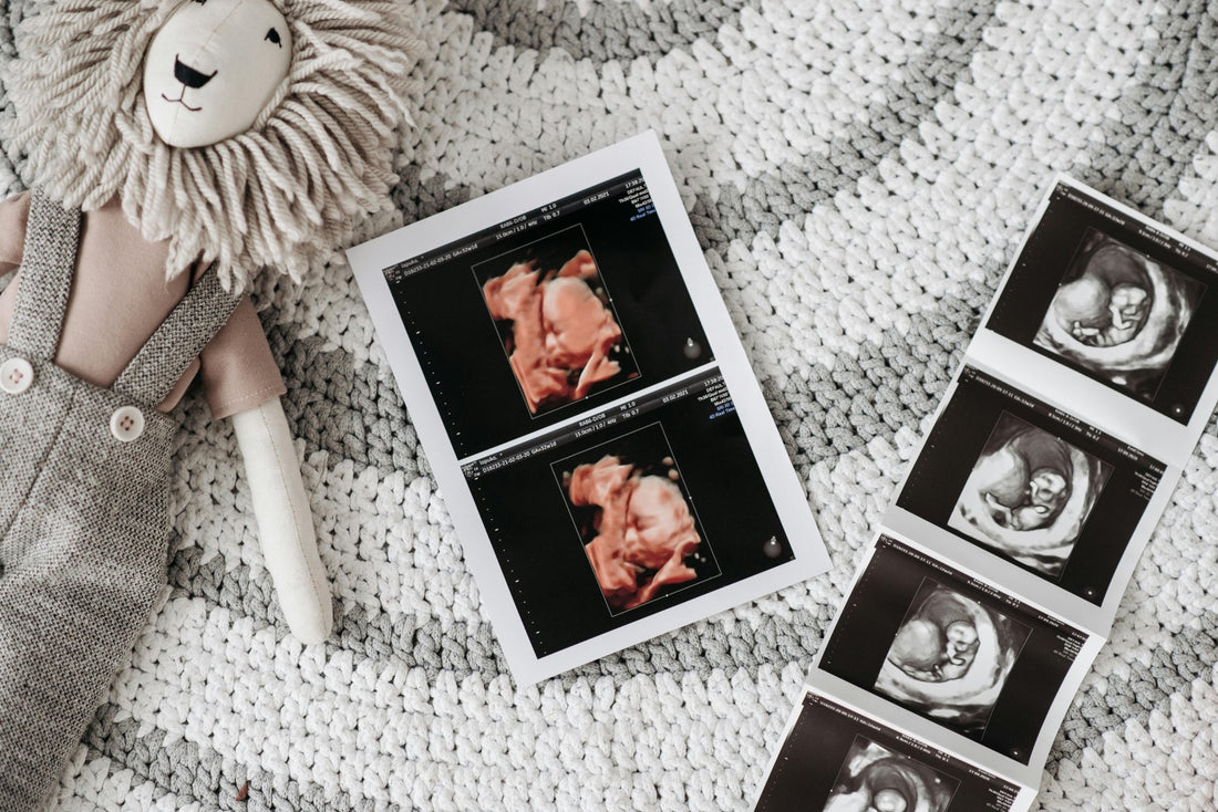 Pregnancy Announcement Keepsake: A Personalized Photo Music Memory Plaque with a Heartfelt Message - Customizable Love